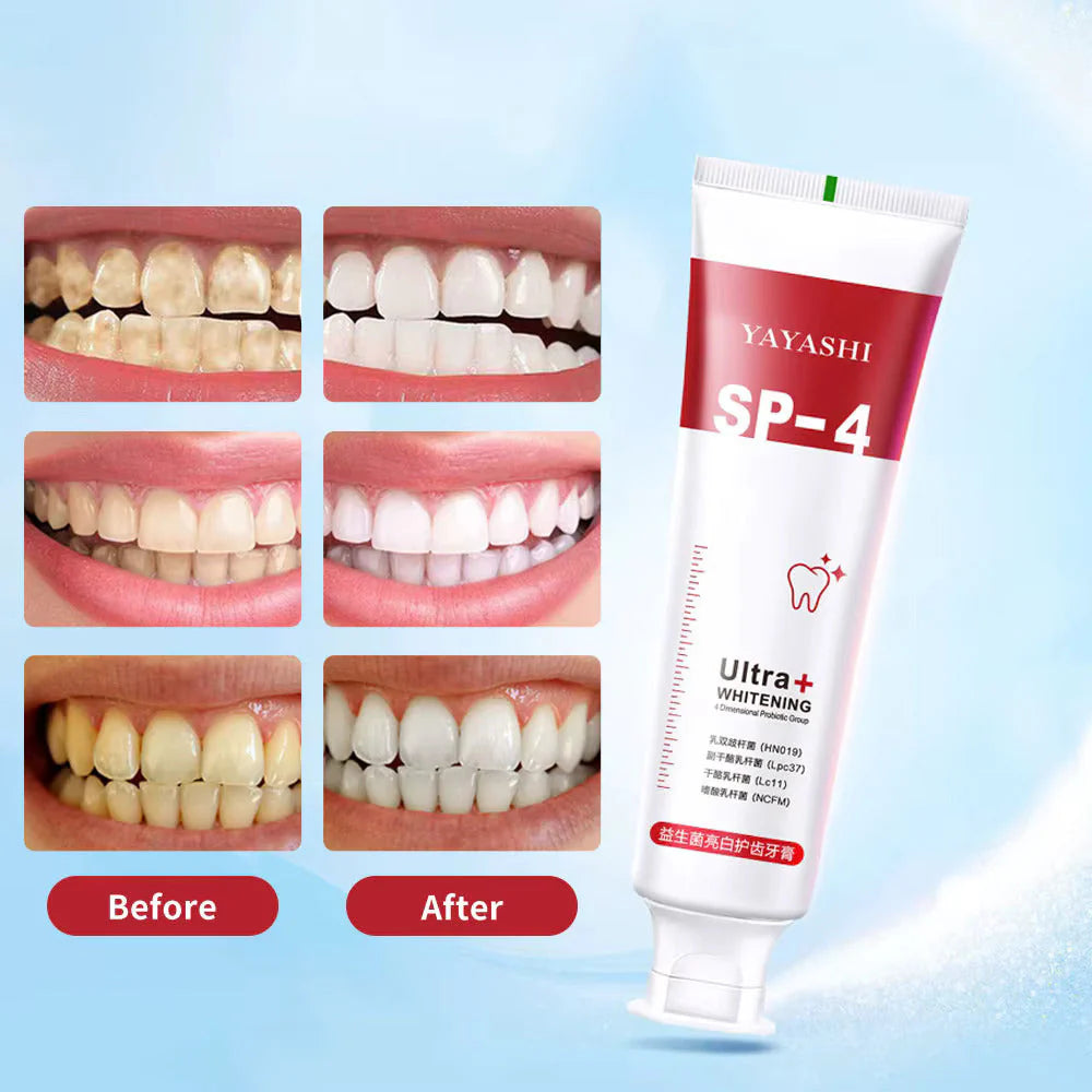 Yayashi SP-4 Probiotic Whitening Toothpaste (Original)