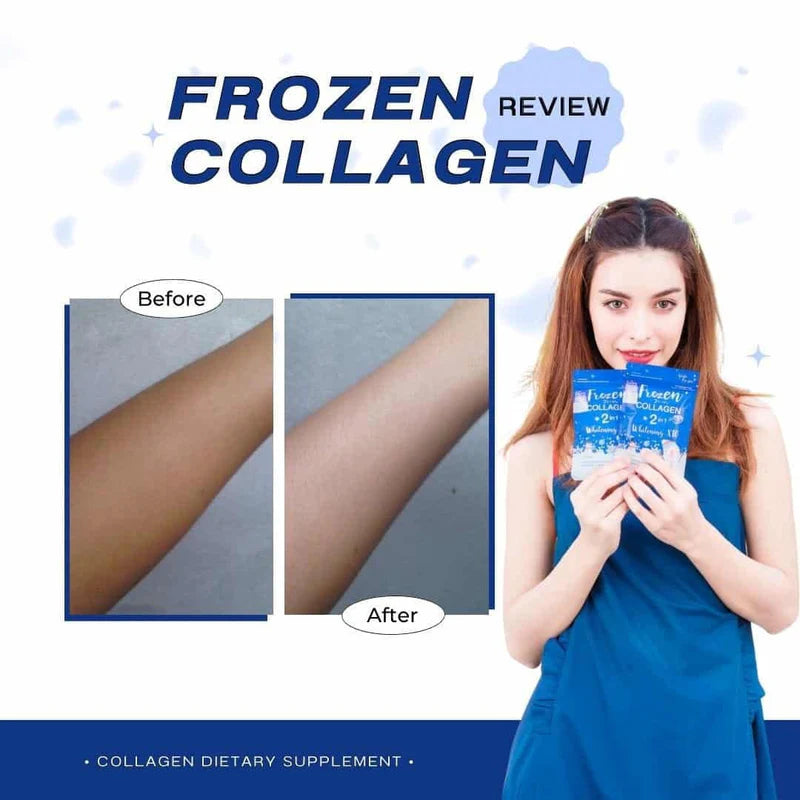 Frozen Collagen 2 in 1 Whitening x10 - 60 Caps